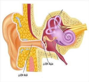 Read more about the article كيفية علاج أنماط ضعف السمع القابل للعلاج